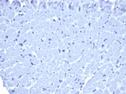 Mouse IgG1 Isotype Control Antibody Human Heart IHC. Immunohistochemistry staining of FFPE human heart tissue using Mouse IgG1 Isotype Control Antibody (clone IGG1/1331) demonstrates absence of specific HRP-DAB staining, with only minimal background signal observed throughout the cardiac tissue. The lack of distinct cellular labeling supports the utility of this reagent as a negative control for assessment of nonspecific antibody binding and background staining in immunohistochemical assays. Heat-induced epitope retrieval was performed by boiling tissue sections in pH 9 Tris-EDTA buffer (10 mM Tris, 1 mM EDTA) for 20 minutes followed by cooling prior to staining.