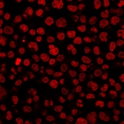Mouse IgG1 Isotype Control Antibody Raji IF. Immunofluorescence staining of PFA-fixed human Raji cells using Mouse IgG1 Isotype Control Antibody (clone IGG1/1331) demonstrates absence of specific fluorescence staining, with only minimal background signal observed throughout the cell population. The lack of distinct cellular labeling supports the use of this reagent as a negative control for assessment of nonspecific antibody binding and background fluorescence in immunofluorescence assays. Nuclei are visualized with RedDot nuclear stain (red). The observed staining profile confirms the suitability of this Mouse IgG1 Isotype Control Antibody for validation of fluorescence-based antibody experiments.