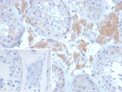 GDF9 Antibody Ovary IHC. Immunohistochemistry analysis of FFPE human ovary tissue stained with GDF9 Antibody clone GDF9/6458 demonstrates cytoplasmic HRP-DAB brown staining within ovarian follicle-associated cellular populations, consistent with expression of Growth differentiation factor 9 / GDF9 in oocyte-derived signaling and folliculogenesis-associated regulatory pathways. The observed staining profile aligns with the established role of GDF9 in ovarian follicle maturation, granulosa cell communication, and female reproductive endocrine signaling. The negative control inset using PBS in place of primary antibody demonstrates minimal background secondary antibody binding.