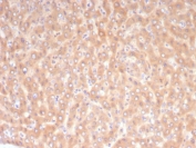 IHC staining of FFPE human liver tissue with 10-Formyltetrahydrofolate dehydrogenase antibody (clone ALDH1L1/7968). HIER: boil tissue sections in pH 9 10mM Tris with 1mM EDTA for 20 min and allow to cool before testing.