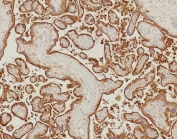 IHC staining of FFPE human placenta tissue with recombinant Epidermal growth factor receptor antibody (clone EGFR/9166R). HIER: boil tissue sections in pH 9 10mM Tris with 1mM EDTA for 20 min and allow to cool before testing.