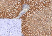 IHC staining of FFPE human liver tissue with Alpha-2-Macroglobulin antibody (clone A2M/6553). Inset: PBS used in place of primary Ab (secondary Ab negative control). HIER: boil tissue sections in pH 9 10mM Tris with 1mM EDTA for 20 min and allow to cool before testing.