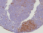 Cystatin A Antibody Human Lymph Node Immunohistochemistry. IHC staining of FFPE human lymph node tissue with recombinant Cystatin A antibody (clone CSTA/9087R). HIER: boil tissue sections in pH 9 10mM Tris with 1mM EDTA for 20 min and allow to cool before testing.