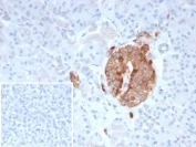 Immunohistochemistry of COL4A3 antibody in human pancreas tissue. Formalin-fixed, paraffin-embedded human pancreas was stained using recombinant rabbit monoclonal COL4A3 antibody (clone COL4A3/9395R). Heat induced epitope retrieval was performed by boiling tissue sections in 10mM Tris with 1mM EDTA, pH 9, for 20 min followed by cooling prior to staining. Brown chromogenic signal outlines basement membrane structures and vascular profiles, consistent with Collagen IV alpha 3 chain localization in the extracellular matrix. The inset shows PBS used in place of primary antibody as a secondary-only negative control.