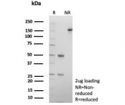 SDS-PAGE analysis of purified, BSA-free COL4A3 antibody (clone COL4/9395R) as confirmation of integrity and purity.