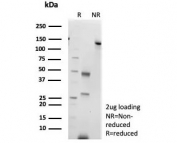 SDS-PAGE analysis of purified, BSA-free Colipase antibody (clone CLPS/9026) as confirmation of integrity and purity.