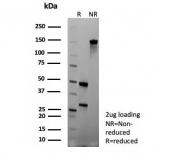 SDS-PAGE analysis of purified, BSA-free Colipase antibody (clone CLPS/9027) as confirmation of integrity and purity.