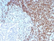 Immunohistochemistry analysis of CD3 delta antibody (clone CD3D/8898) in human tonsil tissue. Formalin-fixed, paraffin-embedded tonsil demonstrates strong membranous HRP-DAB brown staining in interfollicular T lymphocytes, consistent with CD3 complex expression in mature T cells. Germinal center B cell regions show minimal staining, highlighting the expected T cell-restricted distribution. Hematoxylin counterstain delineates nuclear morphology and tonsillar architecture. The inset shows PBS used in place of primary antibody as a negative control, confirming absence of non-specific secondary antibody binding. Heat-induced epitope retrieval was performed by boiling tissue sections in 10 mM Tris with 1 mM EDTA, pH 9.0, for 20 minutes followed by cooling prior to staining.