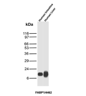 FABP1 Antibody Tissue WB. Western blot analysis of human intestine and human liver tissue lysates using FABP1 antibody clone FABP1/4462. A strong band is detected at approximately 14 kDa, consistent with the predicted molecular weight of Fatty acid-binding protein 1 / FABP1, with expected enriched expression in intestine and liver tissues.