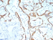 IHC staining of FFPE human placental tissue with c-RET/RET Proto-Oncogene antibody (clone RET/8790). Inset: PBS used in place of primary Ab (secondary Ab negative control). HIER: boil tissue sections in pH 9 10mM Tris with 1mM EDTA for 20 min and allow to cool before testing.