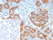 IHC staining of FFPE human prostate tissue with recombinant MME antibody (clone rMME/9377). Inset: PBS used in place of primary Ab (secondary Ab negative control). HIER: boil tissue sections in pH 9 10mM Tris with 1mM EDTA for 20 min and allow to cool before testing.