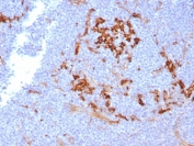 IHC staining of FFPE human lymph node tissue with CD14 antibody (clone LPSR/7738). HIER: boil tissue sections in pH 9 10mM Tris with 1mM EDTA for 20 min and allow to cool before testing.