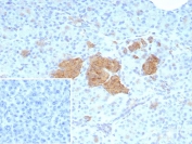NSE gamma Antibody Human Pancreas IHC. Immunohistochemistry staining of FFPE human pancreas tissue with NSE gamma antibody (clone ENO2/9044). Inset: PBS used in place of primary Ab (secondary Ab negative control). HIER: boil tissue sections in pH 9 10mM Tris with 1mM EDTA for 20 min and allow to cool before testing.