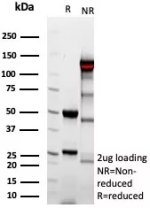 Purified Complement C4d Antibody C4D/9213R Reducing and Non-Reducing SDS-PAGE. SDS-PAGE analysis of purified, BSA-free Complement C4d Antibody clone C4D/9213R demonstrates prominent heavy and light antibody chains at approximately 50 and 25 kDa under reducing conditions. Under non-reducing conditions, the major intact antibody species migrates at approximately 110-125 kDa, with additional lower-molecular-weight species also visible. The gel provides an assessment of the integrity and composition of the purified C4d Fragment Antibody preparation.