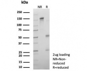 SDS-PAGE analysis of purified, BSA-free recombinant Androgen Receptor V7 antibody (clone DHTR.V7/9394R) as confirmation of integrity and purity.
