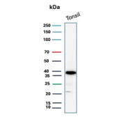 Apolipoprotein J Antibody Tonsil WB. Western blot analysis of human tonsil tissue lysate using Apolipoprotein J antibody. The recombinant rabbit monoclonal antibody clone CLU/9192R detects a prominent band at approximately 36-39 kDa, consistent with the processed alpha and beta subunits of Clusterin / APO-J. This banding pattern reflects proteolytic cleavage and glycosylation of this secreted chaperone protein, with strong detection in tonsil aligning with its role in extracellular protein regulation within immune-rich tissue environments.