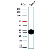 Clusterin Antibody Tonsil WB. Western blot analysis of human tonsil tissue lysate using Clusterin antibody. The recombinant antibody clone rCLU/9149 detects a strong band at approximately 36-39 kDa, consistent with the predicted molecular weight of the processed alpha and beta subunits of Clusterin / CLU. Robust signal in tonsil reflects expression of this secreted chaperone protein in immune-rich lymphoid tissue, aligning with its role in extracellular protein stabilization and immune microenvironment regulation.