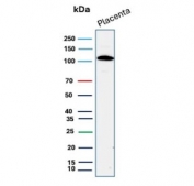 E-cadherin Antibody for WB in human placental tissue. Western blot analysis of Cadherin 1 / CDH1 expression using clone CDH1/9226R antibody, showing a band near the predicted molecular weight of E-cadherin. E-cadherin is synthesized as a precursor and undergoes glycosylation, resulting in an apparent molecular weight typically observed between approximately 80-120 kDa, with the precursor form near 135 kDa. The detected band is consistent with mature glycosylated E-cadherin associated with polarized epithelial tissue structure.