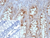 E-cadherin Antibody Colon IHC. Immunohistochemistry analysis of Cadherin 1 / CDH1 expression in FFPE human colon tissue using clone CDH1/9226R antibody, showing strong membranous HRP-DAB brown staining in epithelial cells lining glandular structures with clear lateral membrane localization consistent with epithelial polarity, while surrounding stromal tissue remains largely negative. Inset: PBS used in place of primary Ab (secondary Ab negative control). HIER: boil tissue sections in pH 9 10mM Tris with 1mM EDTA for 20 min and allow to cool before testing. Signal highlights organized epithelial architecture and polarity maintenance within colon mucosa.