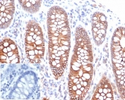 Cadherin 1 Antibody for IHC. Immunohistochemistry analysis of Cadherin 1 / CDH1 expression in FFPE human colon tissue using clone rCDH1/6769 antibody, showing strong membranous HRP-DAB brown staining in epithelial cells lining glandular structures with clear cell-cell junction localization, while surrounding stromal tissue remains largely negative. Inset: PBS used in place of primary Ab (secondary Ab negative control). HIER: boil tissue sections in pH 9 10mM Tris with 1mM EDTA for 20 min and allow to cool before testing. Signal highlights organized epithelial architecture and intercellular junction assembly within colon mucosa.