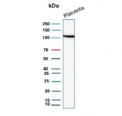 E-cadherin Antibody for WB in human placental tissue. Western blot analysis of Cadherin 1 / CDH1 expression using clone CDH1/9615R antibody, showing a band near the predicted molecular weight of E-cadherin. E-cadherin is synthesized as a precursor and undergoes glycosylation, resulting in an apparent molecular weight typically observed between approximately 80-120 kDa, with the precursor form near 135 kDa. The detected band is consistent with mature glycosylated E-cadherin, and reduced expression of CDH1 is commonly associated with epithelial-to-mesenchymal transition in disease contexts.