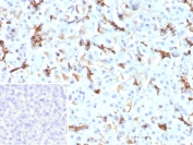 CFTR Antibody Pancreatic Tissue IHC. Immunohistochemistry staining of FFPE human pancreas tissue with recombinant CFTR antibody (clone CFTR/9148R). Inset: PBS used in place of primary Ab (secondary Ab negative control). HIER: boil tissue sections in pH 9 10mM Tris with 1mM EDTA for 20 min and allow to cool before testing.