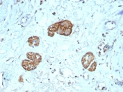 CD56 Extracellular Domain Antibody (clone NCAM1/9121R). Immunohistochemistry of FFPE human colon tissue demonstrates membranous and cytoplasmic staining in scattered neural and neuroendocrine-associated cell clusters consistent with expression of Neural cell adhesion molecule 1 (NCAM1), also known as CD56. Brown chromogenic signal highlights CD56-positive cells within localized structures embedded in the surrounding stromal tissue, while most epithelial and stromal cells show minimal staining. Heat-induced epitope retrieval was performed by boiling tissue sections in pH 9 10mM Tris with 1mM EDTA for 20 minutes followed by cooling prior to antibody incubation.