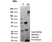 SDS-PAGE analysis of purified Carcinoembryonic Antigen-Related CEACAM1 antibody (clone CEACAM1/4837) as confirmation of integrity and purity.