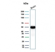 Western blot testing of human brain tissue lysate with recombinant GFAP antibody (clone rGFAP/9150). Predicted molecular weight ~50 kDa.