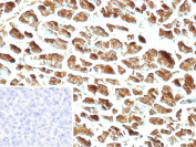 Carboxypeptidase A1 Antibody Pancreas IHC. Immunohistochemistry of Carboxypeptidase A1 / CPA1 in FFPE human pancreas tissue using recombinant rabbit monoclonal Carboxypeptidase A1 antibody, clone CPA1/9622R. Strong HRP-DAB brown cytoplasmic staining highlights pancreatic acinar cells, consistent with the enzymeâs role in digestive protein processing, while nuclei are counterstained blue. The staining pattern shows robust and uniform labeling of acinar cell populations with minimal background signal. Inset: PBS was used in place of primary antibody as a negative control to confirm specificity of staining. Heat induced epitope retrieval was performed by boiling tissue sections in pH 9 10 mM Tris with 1 mM EDTA for 20 min followed by cooling prior to staining.