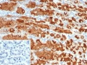 Immunohistochemistry analysis of MUC1 / Mucin 1 antibody (clone r115D8) in human stomach tissue. FFPE human stomach section shows strong membranous and apical cytoplasmic brown chromogenic staining in gastric epithelial cells lining glandular structures, consistent with MUC1 expression, while surrounding stromal cells show minimal staining and nuclei appear blue. The inset shows PBS used in place of primary antibody as a negative control with no specific staining observed. Heat-induced epitope retrieval was performed by boiling tissue sections in pH 9 10 mM Tris with 1 mM EDTA for 20 minutes followed by cooling prior to staining.