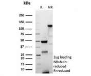 SDS-PAGE analysis of purified, BSA-free recombinant CD44v6 (CD44V6/9400R) as confirmation of integrity and purity.