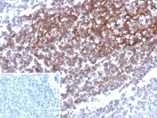 CD35 Antibody Tonsil IHC. Immunohistochemistry of CD35 / CR1 in FFPE human tonsil tissue using mouse monoclonal CD35 antibody, clone CR1/9444. HRP-DAB brown staining highlights a dense reticular follicular dendritic cell network within germinal centers, consistent with complement receptor localization, while surrounding lymphocytes show minimal staining and nuclei are counterstained blue. Inset: PBS was used in place of primary antibody as a negative control to confirm specificity of staining.