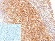 CR2 Antibody B-Cell Zone IHC. Immunohistochemistry of Complement Receptor 2 / CR2 in FFPE human tonsil tissue using recombinant mouse monoclonal CR2 antibody, clone rCR2/9537. HRP-DAB brown staining highlights dense membranous labeling of B lymphocytes within germinal center regions, consistent with its role as a B-cell co-receptor, with a subtle reticular pattern reflecting associated follicular dendritic cell networks, while nuclei are counterstained blue. Inset: PBS was used in place of primary antibody as a negative control to confirm specificity of staining. Heat induced epitope retrieval was performed by boiling tissue sections in pH 9 10 mM Tris with 1 mM EDTA for 20 min followed by cooling prior to staining.