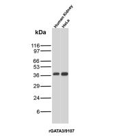 GATA3 Antibody Human Kidney and HeLa WB. Western blot analysis of human kidney and HeLa cell lysates using recombinant GATA3 Antibody / GATA Binding Protein 3 Antibody clone rGATA3/9107. A distinct band is detected at approximately 40 kDa, consistent with reported migration patterns of GATA binding protein 3 / GATA3, a zinc finger transcription factor involved in epithelial differentiation and T-cell lineage regulation.