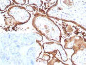 MIG9 Antibody Recombinant Rabbit MAb S100P/9135R in human placental tissue. Immunohistochemistry staining of FFPE human placenta demonstrates cytoplasmic staining in trophoblastic epithelial cells consistent with expression of migration inducing gene 9 / S100 calcium binding protein P (S100P). Brown chromogenic signal highlights S100P-positive trophoblast layers within placental villi while surrounding stromal elements show comparatively weaker staining. The inset shows PBS used in place of primary antibody as a secondary-only negative control. Heat-induced epitope retrieval was performed by boiling tissue sections in pH 9 Tris buffer with 1 mM EDTA for 20 min before staining.