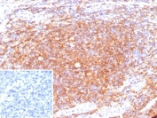 IHC analysis of CD40 Antibody in FFPE human tonsil tissue. The rabbit monoclonal antibody (clone C40/9225R) demonstrates strong membranous HRP-DAB brown staining in B lymphocytes within germinal centers and interfollicular regions, consistent with TNFRSF5 / CD40 expression, while surrounding stromal elements are largely negative. The inset shows PBS used in place of the primary antibody as a secondary-only negative control. Heat-induced epitope retrieval was performed in 10mM Tris with 1mM EDTA, pH 9.0, at 95oC for 20 minutes followed by cooling before testing.