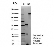 PAX6 Antibody Recombinant Mouse MAb rPAX6/9324 SDS-PAGE analysis of antibody integrity and purity. Purified BSA-free antibody was analyzed under reducing (R) and non-reducing (NR) conditions with 2 ug protein loading. The gel demonstrates the expected antibody heavy and light chain bands under reducing conditions and intact antibody under non-reducing conditions, confirming purity and structural integrity of the recombinant mouse monoclonal antibody.