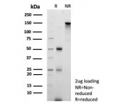 SDS-PAGE analysis of purified, BSA-free S100A4 antibody (clone S100A4/6796) as confirmation of integrity and purity.
