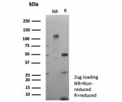 SDS-PAGE analysis of purified, BSA-free recombinant NCAM-L1 antibody (clone L1CAM/9146R) as confirmation of integrity and purity.