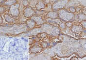 IHC staining of FFPE human placenta tissue with CD147/Basigin  antibody (clone BSG/9223R). Inset: PBS used in place of primary Ab (secondary Ab negative control). HIER: boil tissue sections in pH 9 10mM Tris with 1mM EDTA for 20 min and allow to cool before testing.
