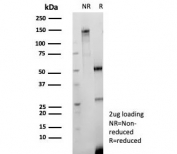 SDS-PAGE analysis of purified recombinant CD147/Emmprin antibody (clone BSG/9290R) as confirmation of integrity and purity.