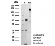 SDS-PAGE analysis of purified recombinant Bcl-6 antibody (clone BCL6/9222R) as confirmation of integrity and purity.