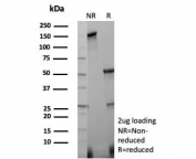 SDS-PAGE analysis of purified, BSA-free Caspase 3 antibody (clone CASP3/8446) as confirmation of integrity and purity.