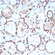 TTF-1 Antibody for IHC / TTF-1 Immunohistochemistry Antibody (clone NX2.1/9035) immunohistochemistry analysis of human thyroid tissue. Formalin-fixed, paraffin-embedded human thyroid tissue stained with mouse monoclonal clone NX2.1/9035 antibody demonstrates strong nuclear staining in thyroid follicular epithelial cells, consistent with the nuclear localization of Thyroid transcription factor 1 (TTF-1 / NKX2-1). The nuclear immunoreactivity highlights TTF-1 expression within follicular epithelial cells in FFPE thyroid tissue sections analyzed by immunohistochemistry. HIER: boil tissue sections in pH 9 10mM Tris with 1mM EDTA for 20 min and allow to cool before testing.