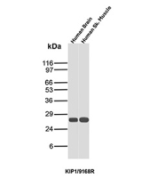 p27 Antibody Human Tissue WB. Western blot analysis of p27 / CDKN1B expression in human tissue lysates using p27 antibody clone KIP1/9168R. Lane 1: human brain lysate, Lane 2: human skeletal muscle lysate. A band is detected at approximately 27-29 kDa in both samples, consistent with the predicted molecular weight of p27 (CDKN1B), a key regulator of cell cycle arrest. Detection across distinct human tissue types supports the use of this clone for western blot analysis in human samples.