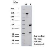 SDS-PAGE analysis of purified, BSA-free p57 antibody (clone KIP2/7639) as confirmation of integrity and purity.