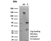 SDS-PAGE analysis of purified, BSA-free CNN1 antibody (clone rCNN1/9164) as confirmation of integrity and purity.