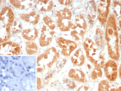 Immunohistochemistry analysis of Cadherin 6 (CDH6) expression. K-Cadherin antibody (clone CDH6/9300R) staining was performed on formalin-fixed, paraffin-embedded human kidney tissue, showing DAB-positive membranous and cytoplasmic staining in renal tubular epithelial cells, with hematoxylin counterstaining. The inset shows a negative control processed in parallel using PBS in place of the primary antibody, demonstrating minimal background signal with secondary antibody only.