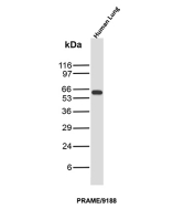 PRAME Antibody Human Lung WB. Western blot analysis of human lung tissue lysate using PRAME antibody clone PRAME/9188. A distinct band is detected at approximately 58-60 kDa, consistent with the expected molecular weight of Preferentially expressed antigen in melanoma / PRAME, a cancer-testis antigen involved in transcriptional regulation and tumor-associated immune signaling pathways.